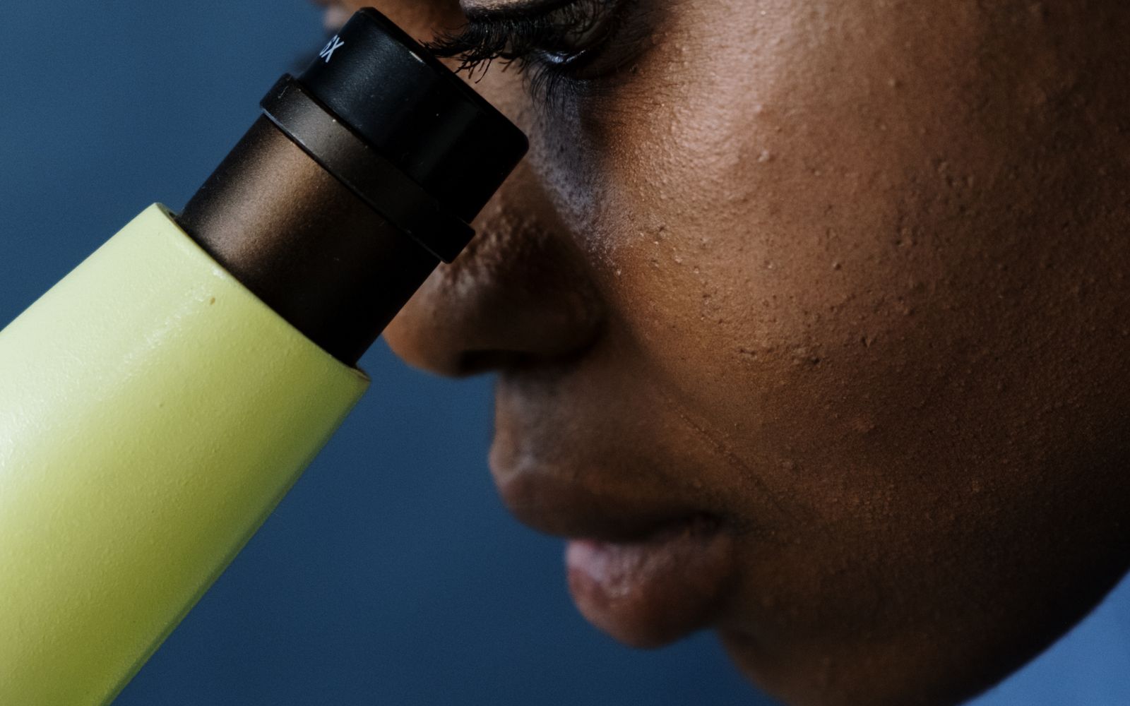 Learn About Malaria From A Medic Perspective